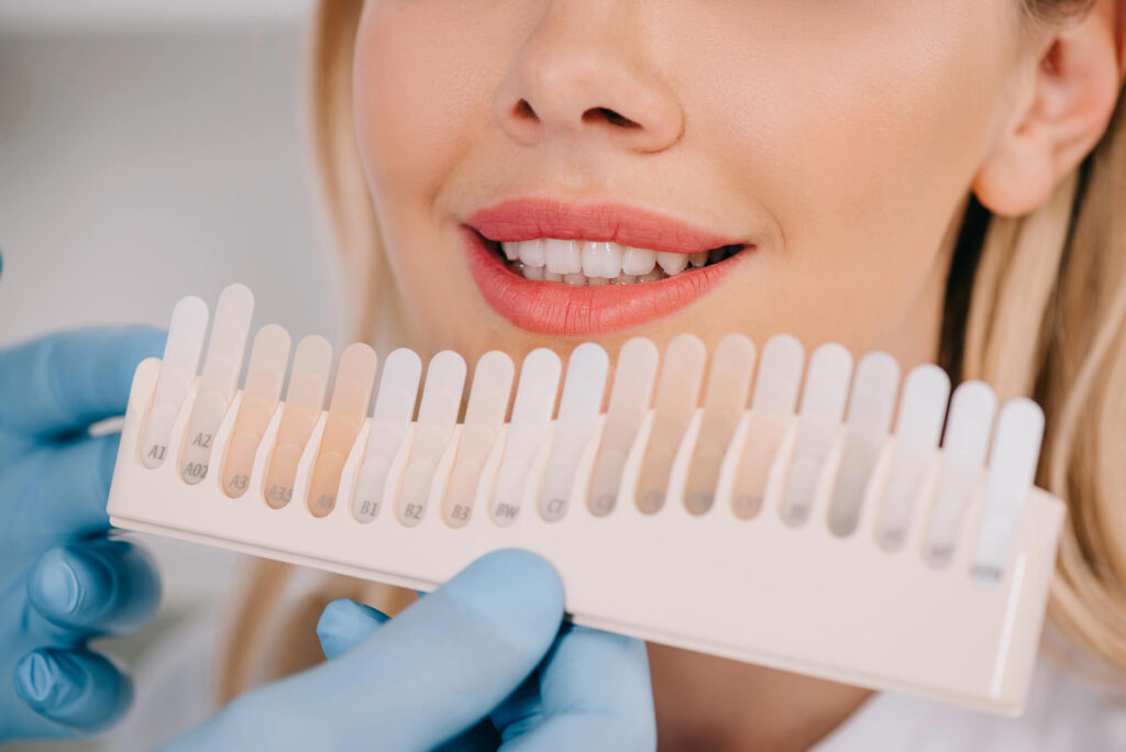 Teeth Whitening with a Cosmetic Dentist in West Palm Beach