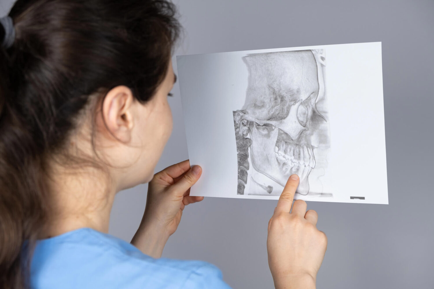 How Botox for TMJ Disorder Helps Diminish the Symptoms